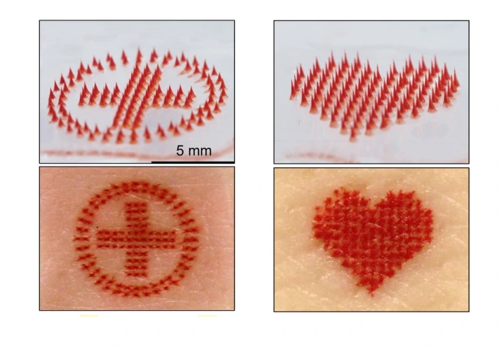 Nova tecnologia de agulhas promete tatuagem sem dor