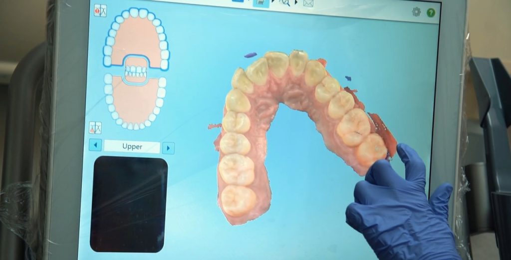 Mapeamento do touchpad de língua da Augmental