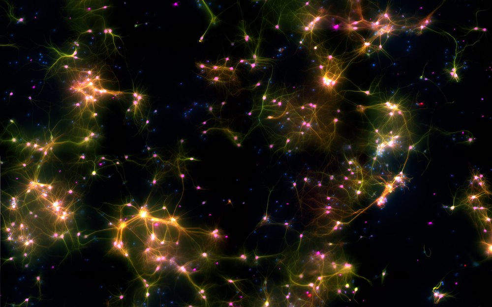 Chip inédito combina células do cérebro humano, eletrônica e inteligência artificial